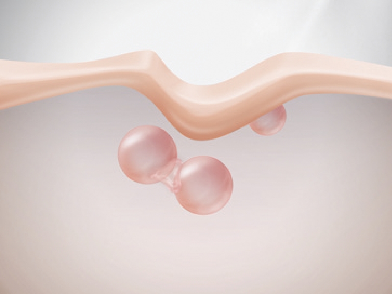 Prima dell'uso di PROTINOL™